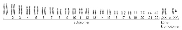 kromosomavvikelser_fig1B-040805