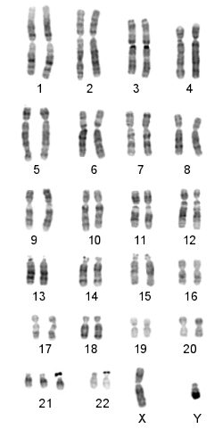 kromosomavvikelser_fig3-040805
